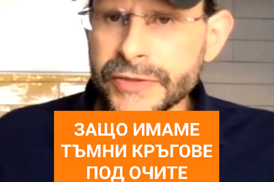 [Видео] Антъни Уилям обяснява причината за тъмните кръгове под очите